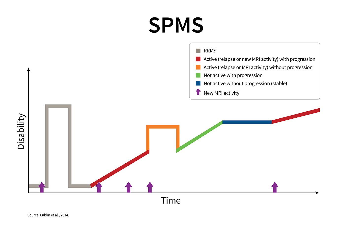 Multicolor line graph showing an example of an SPMS disease course.
